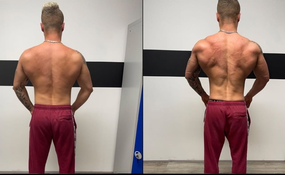 Bodybuilding client transformation — Back thickness & detail
